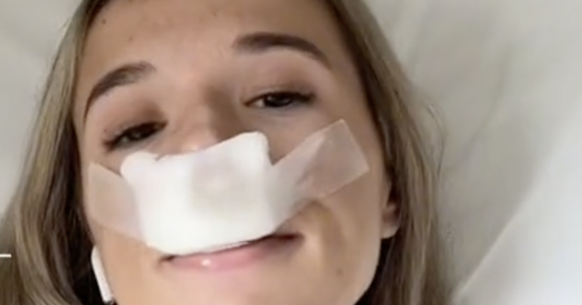 Znana Tiktokerka Poddała Się Operacji Plastycznej Nosa Aby Jej Dzieci Urodziły Się Z ładnym 3340
