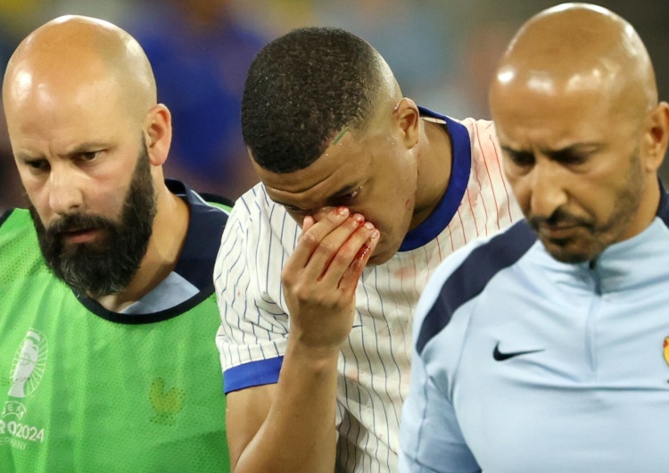 Uraz Mbappe Kylian Mbappé zszedł z boiska cały we krwi. Już wiadomo, co mu się stało 