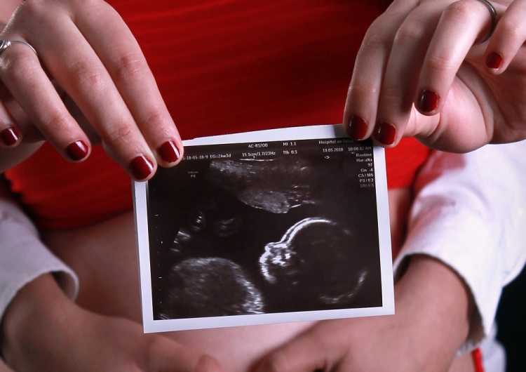 zdjęcie poglądowe Hiszpańskie sądy nakazują mówić prawdę o aborcji