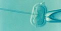 Zapłodnienie in vitro
