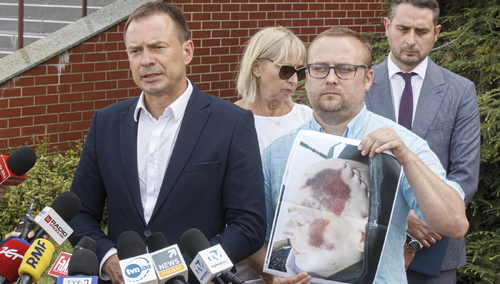 Pełnomocnicy rodziny i rodzina Bartosza S. pokazali na konferencji prasowej zdjęcia ciała 34-latka.