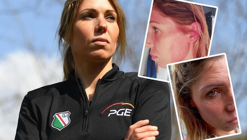 Zofia Klepacka została pobita