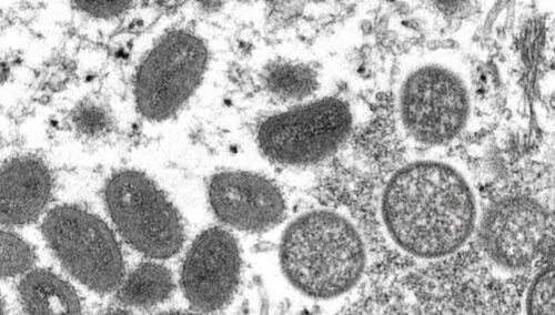 Małpia ospa. W kolejnym kraju w Europie wykryto zakażenie wirusem