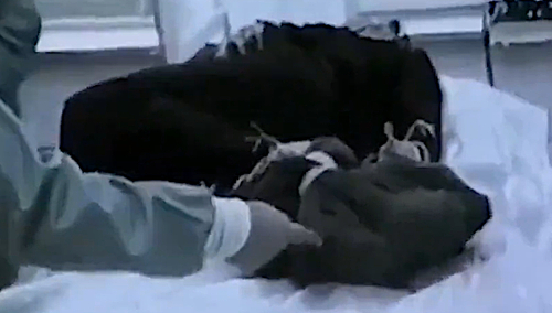 Zwłoki bł. ks. Jerzego Popiełuszki podczas sekcji zwłok