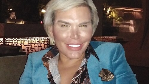 [FOTO] "Żywy Ken" stał się "żywą Barbie", ale to nie wszytko. Oto jak wygląda teraz