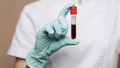 Probówka. Krew. Ilustracja poglądowa