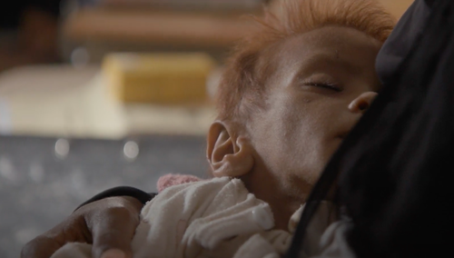 Ofiary głodu w Jemenie