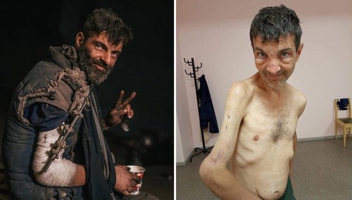 Obrońca Azowstalu wrócił z rosyjskiej niewoli. Te zdjęcia budzą przerażenie