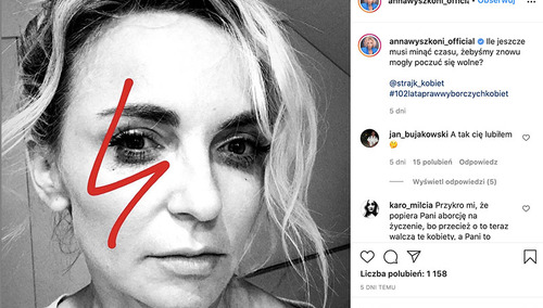 Pozuje z proaborcyjnym piorunem. Śpiewała na płycie „Bóg się rodzi” i „Jezus malusieńki”