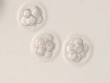 Ośmiokomórkowe zarodki ludzkie