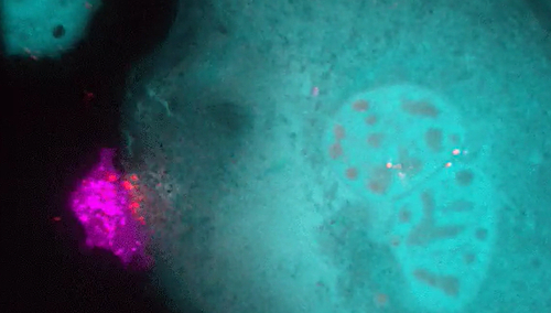 Komórka układu odpornościowego zabija komórkę nowotworową