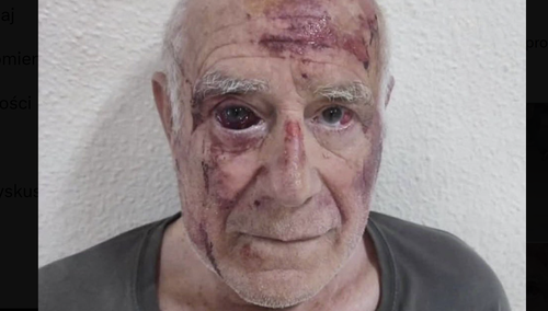 Straszy mężczyzna w Hiszpanii pobity przez grupę młodych imigrantów 