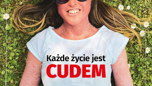 Najnowszy numer "Tygodnika Solidarność": Każde życie jest cudem