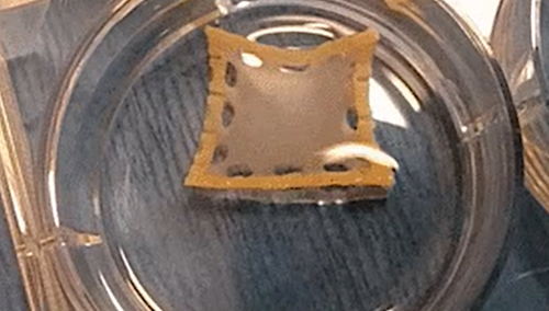 "Pompujący plaster"