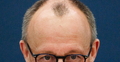 Friedrich Merz