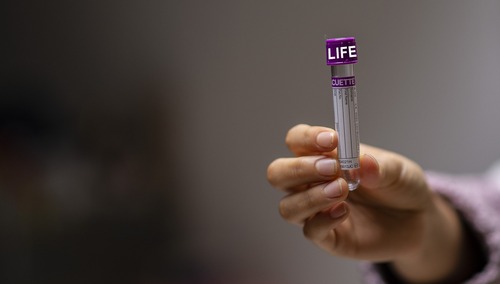 zdjęcie ilustracyjne