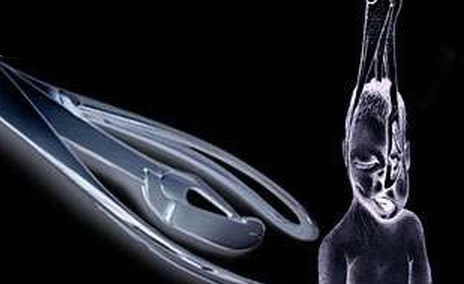 Szokująca aborcyjna propaganda: "Niech płód który uratujesz będzie lesbijką wykonującą aborcję"