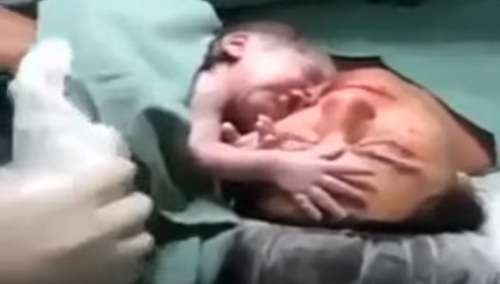 Zakonnice muszą wspierać aborcję. Kontrowersyjna decyzja sądu