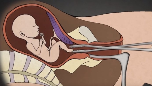 Działacze antyaborcyjni uniewinnieni