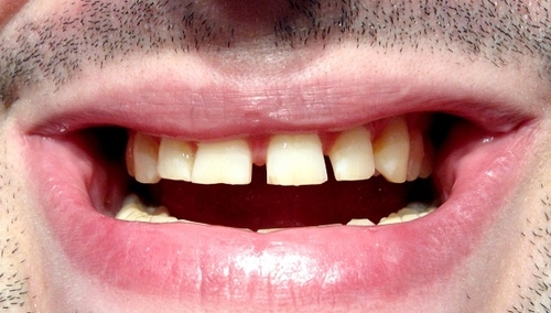 [video] Zobacz jak marszałek Tyszka toczy przysłowiową bekę z nazwy nowego klubu "PO-KO"