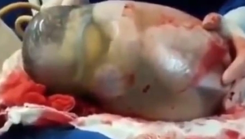 [video] Lekarze zarejestrowali świadectwo cudu życia - rzadka szansa, by zobaczyć to na żywo