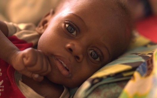 Głód zabija dzieci w Afryce Wschodniej i Południowej! UNICEF Polska apeluje o pomoc